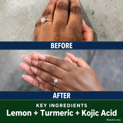 Lemon, Turmeric ＆Kojic acid Soap